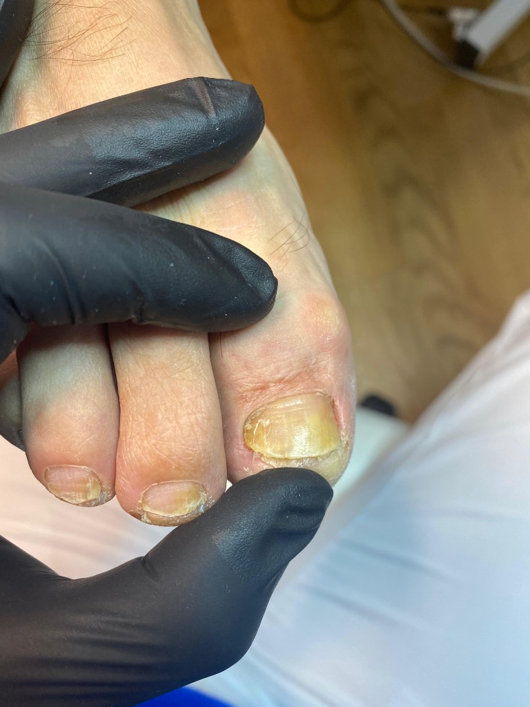 Изменение цвета, несколько ногтей