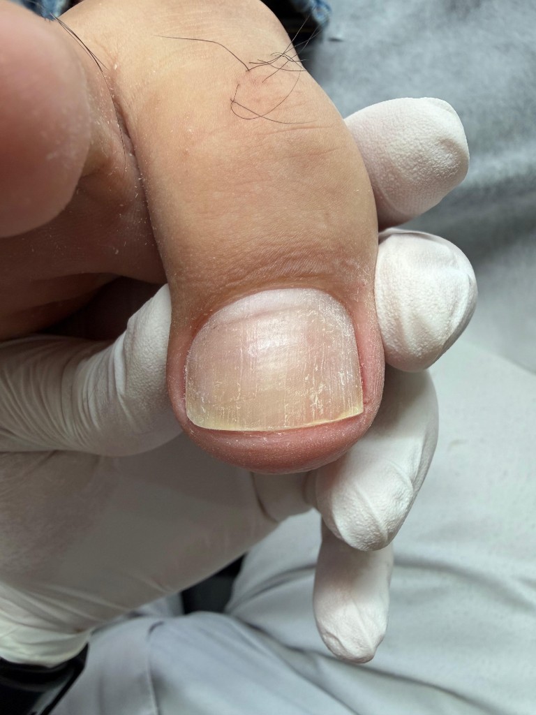 16 марта — результат