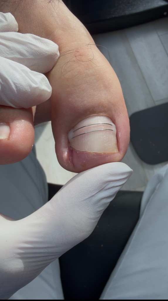 30 ноября — начало