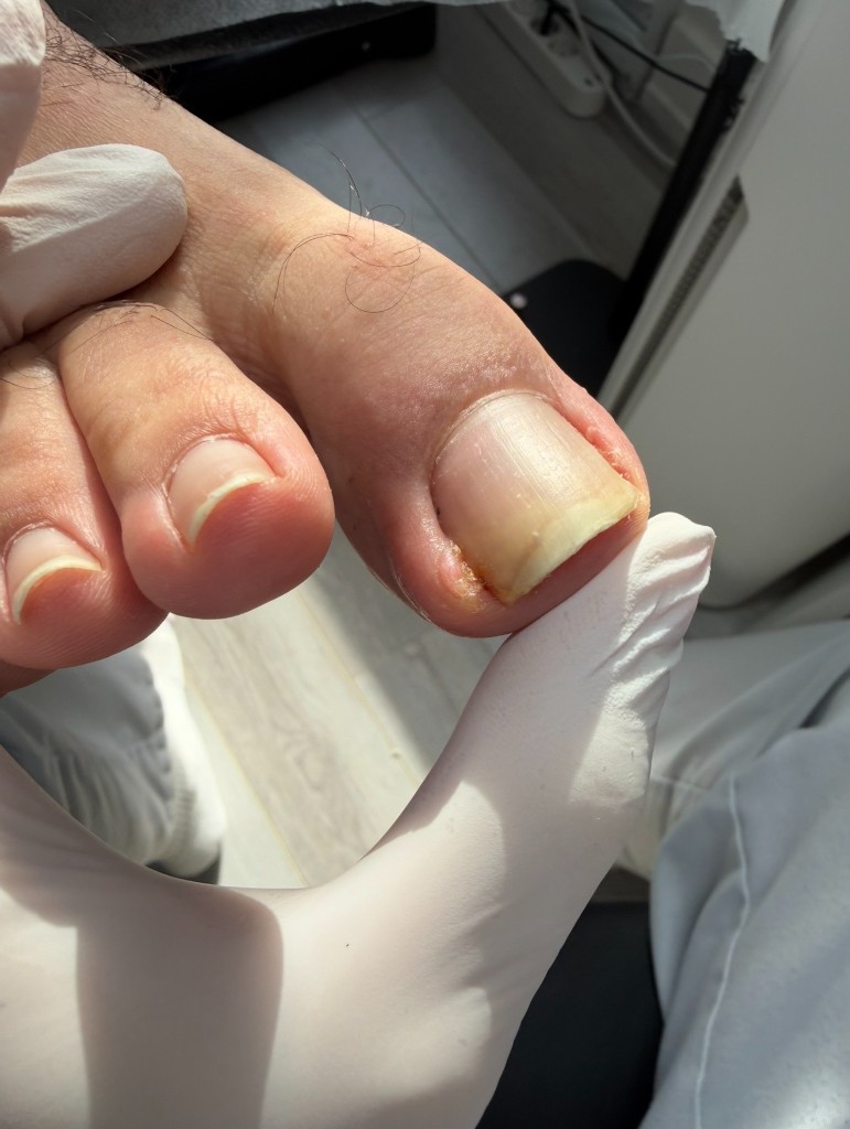 30 ноября — до коррекции